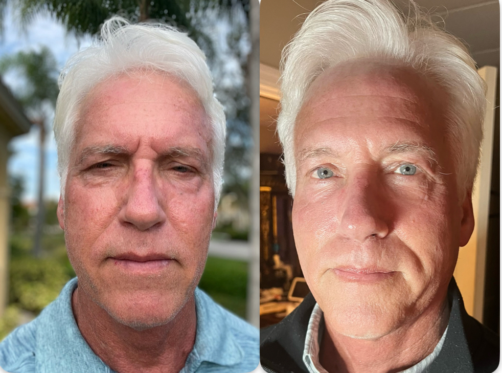 before and after man's treatment